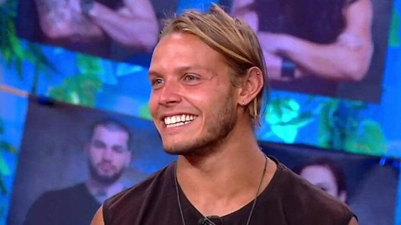 Survivor Murat Ceylan estetik mi yaptırdı? SonHaberler