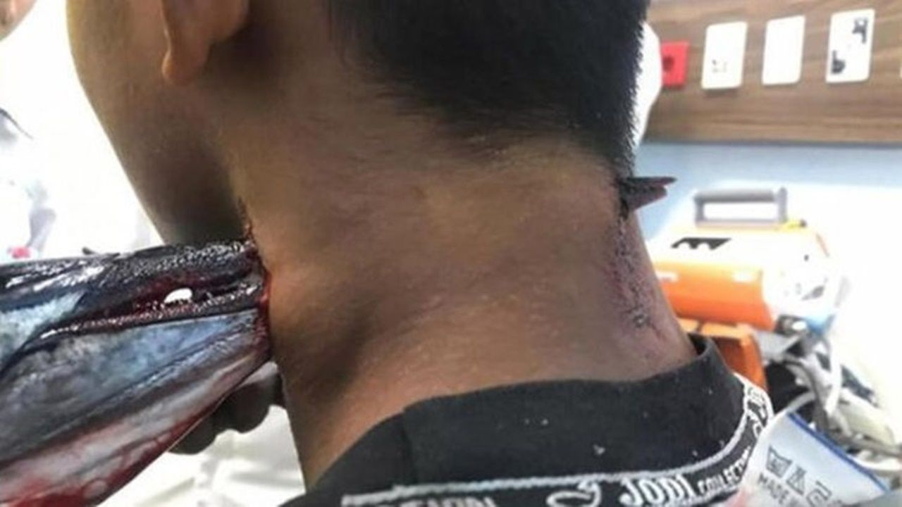 Denizden sıçrayan zargana balığı boynuna saplandı - Sayfa 8