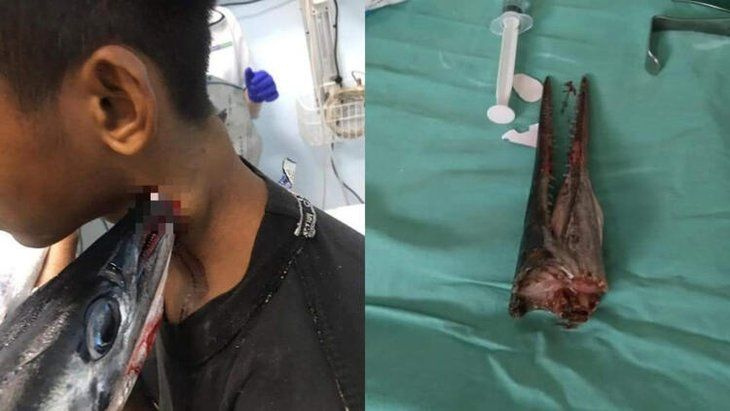 Denizden sıçrayan zargana balığı boynuna saplandı - Sayfa 6