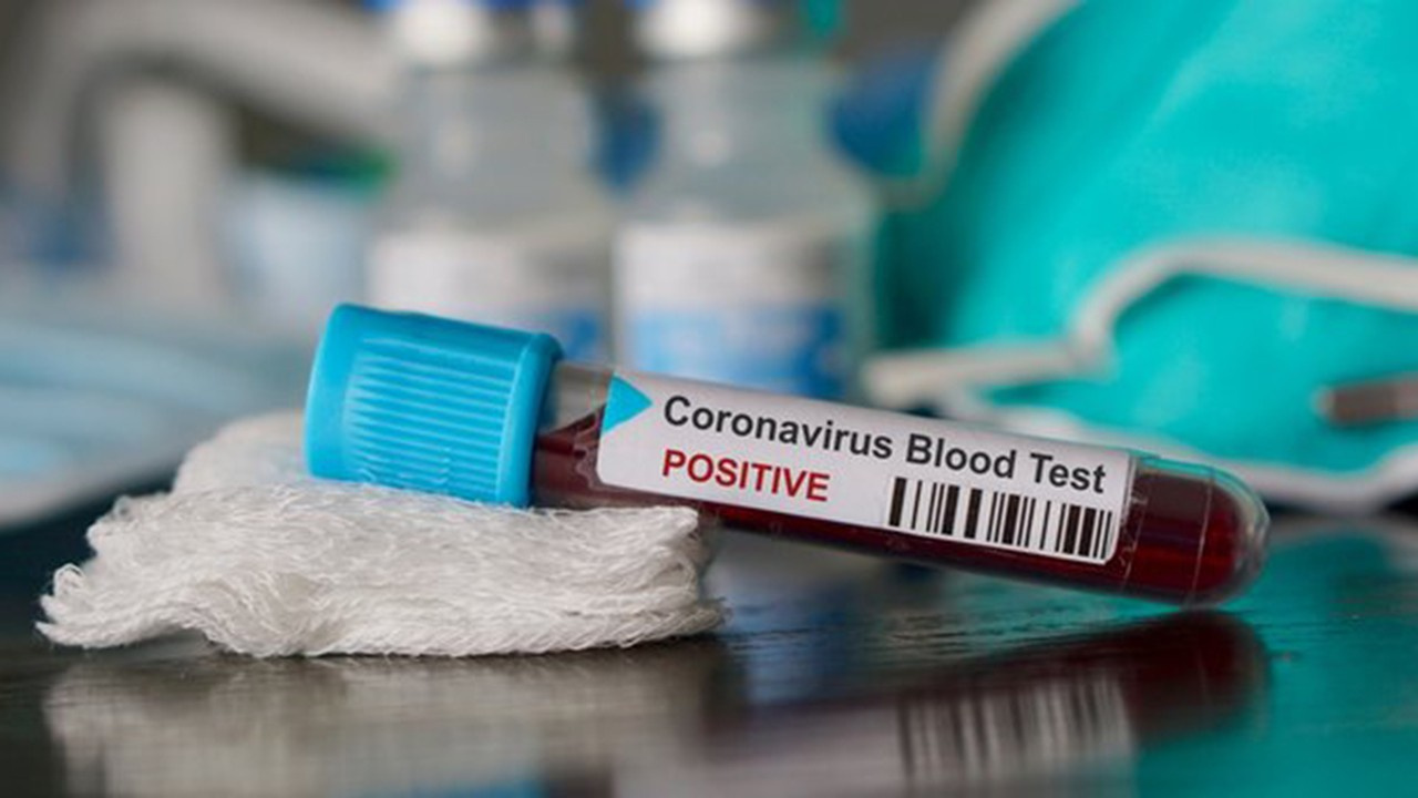 Koronavirüs testi yapan hastaneler, corona virüsü testi nerelerde yapılıyor?