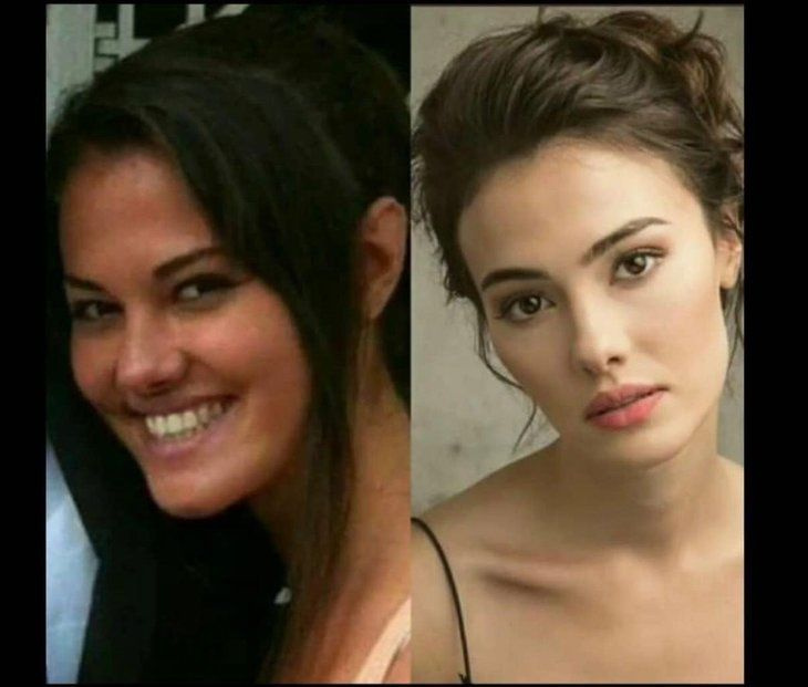 Demet Özdemir'in estetiksiz hali şaşırttı! - Sayfa 16