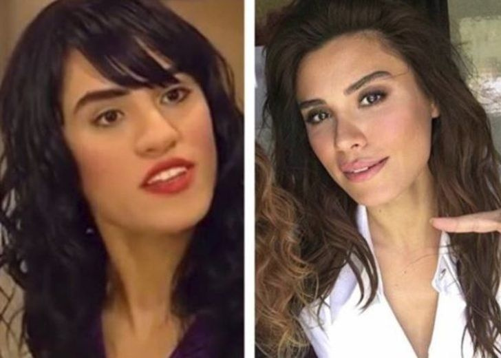 Demet Özdemir'in estetiksiz hali şaşırttı! - Sayfa 9