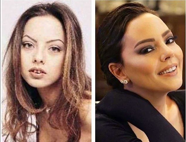 Demet Özdemir'in estetiksiz hali şaşırttı! - Sayfa 18