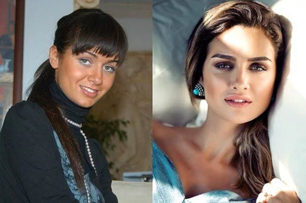 Demet Özdemir'in estetiksiz hali şaşırttı! - Sayfa 19