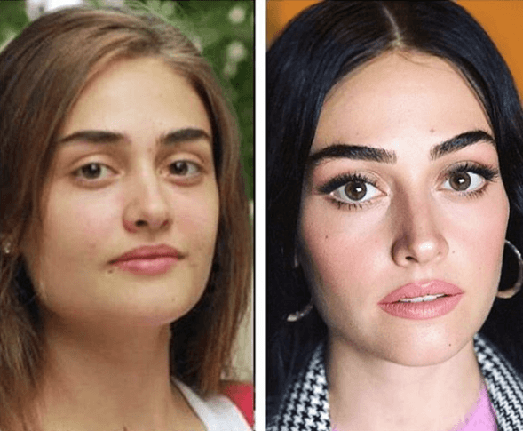 Demet Özdemir'in estetiksiz hali şaşırttı! - Sayfa 21