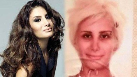 Demet Özdemir'in estetiksiz hali şaşırttı! - Sayfa 5