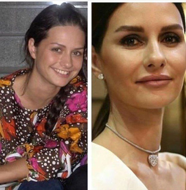 Demet Özdemir'in estetiksiz hali şaşırttı! - Sayfa 7