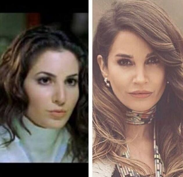 Demet Özdemir'in estetiksiz hali şaşırttı! - Sayfa 8