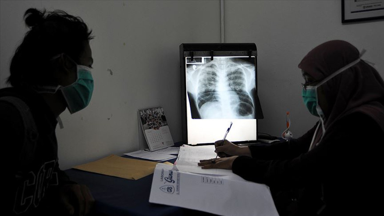 Türkiye'deki tüberküloz ölüm oranı Avrupa'dan iyi