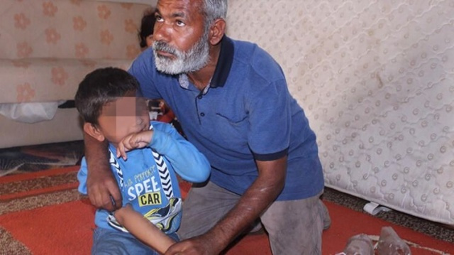 Ailesi ellerini yemesin diye pet şişe takıyor - Sayfa 6
