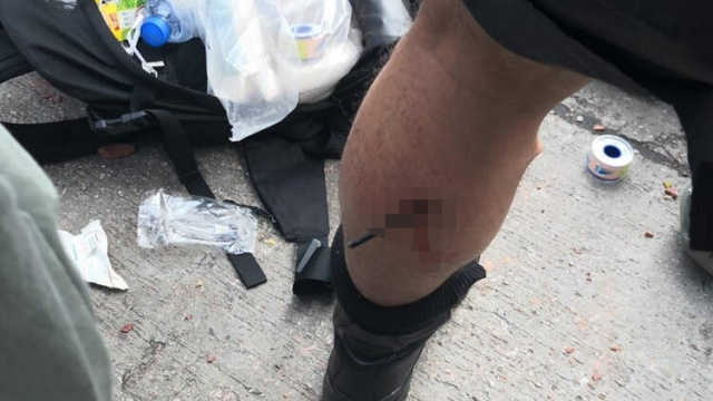 Ellerinde ABD bayraklarıyla polise okla saldırıyorlar - Sayfa 6