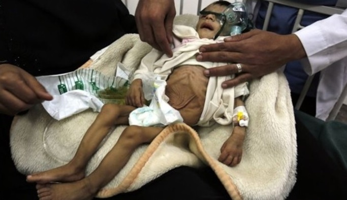 'Yemen kıtlığın eşiğinde'